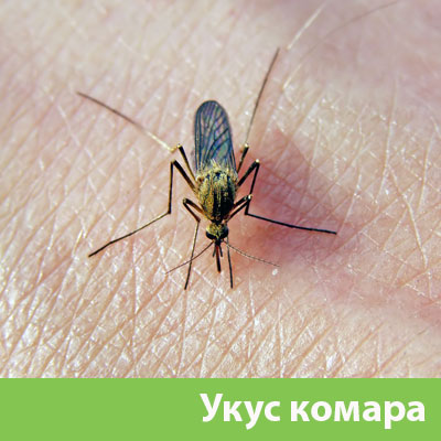 Укусы комаров в Ижевске